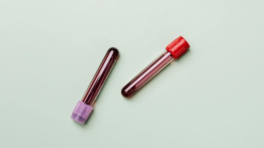 Alarmujące niskie stany krwi – apel o pomoc