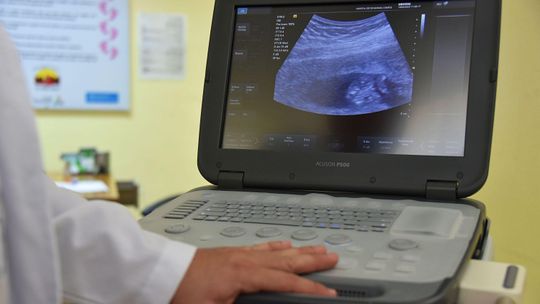 USG Warszawa Ursynów – nowoczesna diagnostyka ultrasonograficzna